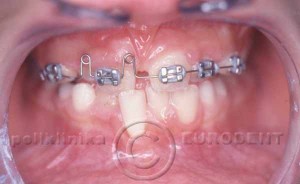 ortodoncija_5 (3)